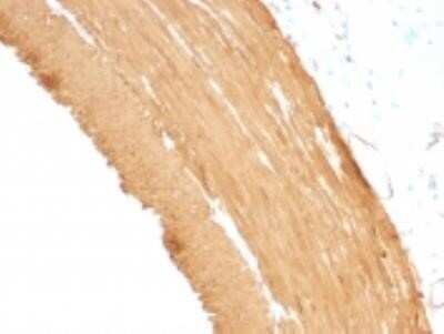Immunohistochemistry-Paraffin: Actin (Muscle Specific) Antibody (MSA/953) - Azide and BSA Free [NBP2-47662]