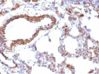 Immunohistochemistry-Paraffin: Actin (Muscle Specific) Antibody (MSA/953) - Azide and BSA Free [NBP2-47662]