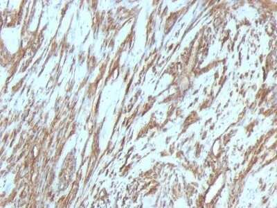 Immunohistochemistry-Paraffin: Actin (Muscle Specific) Antibody (MSA/953) [NBP2-45274]