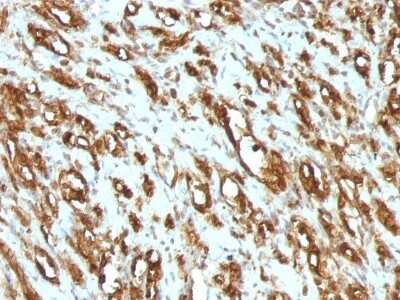 Immunohistochemistry-Paraffin: Actin (Muscle Specific) Antibody (MSA/953) [NBP2-45274]