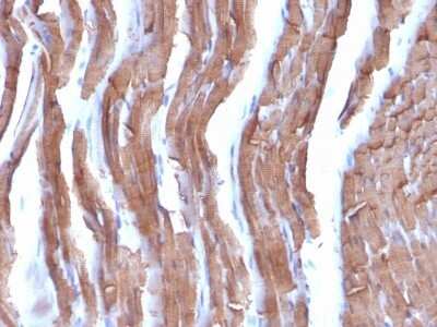 Immunohistochemistry-Paraffin: Actin (Muscle Specific) Antibody (MSA/953) [NBP2-45274]