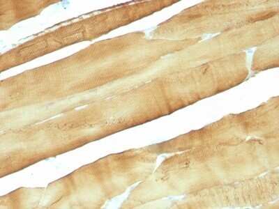 Immunohistochemistry-Paraffin: Actin (Muscle Specific) Antibody (MSA/953) [NBP2-45274]