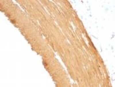 Immunohistochemistry-Paraffin: Actin (Muscle Specific) Antibody (MSA/953) [NBP2-45274]