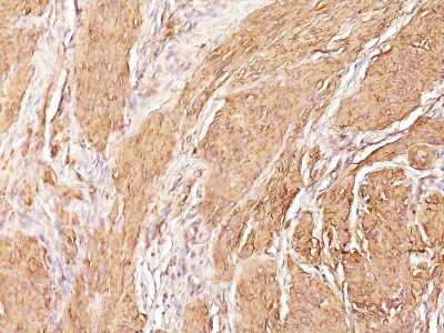 Immunohistochemistry-Paraffin: Actin (Muscle Specific) Antibody (SPM160) [NBP2-34351]