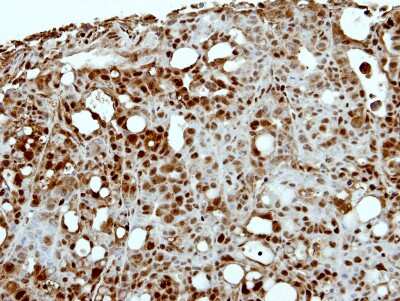 Immunohistochemistry-Paraffin: CapG Antibody [NBP2-15259]