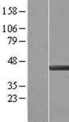 Western Blot: CapG Overexpression Lysate [NBL1-08676]