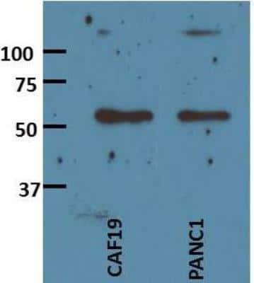 Western Blot: Activin A Antibody (MM0074-7L18)Azide and BSA Free [NBP2-12009]