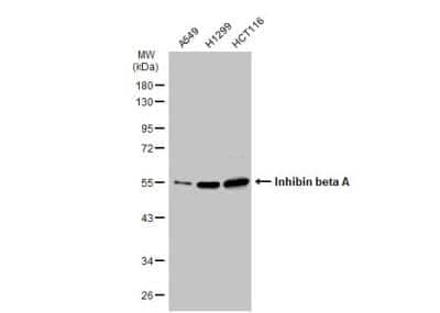 Western Blot: Activin A Antibody [NBP1-30928]