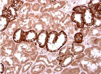 Immunohistochemistry-Paraffin: Activin B/Inhibin beta B Antibody [NBP2-16966]