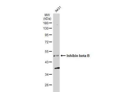 Western Blot: Activin B/Inhibin beta B Antibody [NBP2-16966]