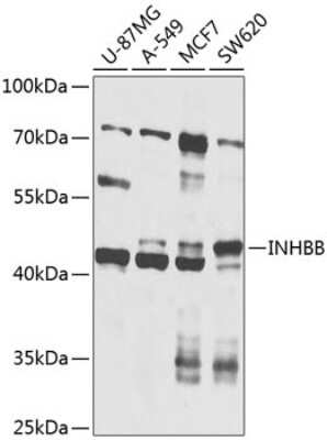 Western Blot: Activin B/Inhibin beta B AntibodyBSA Free [NBP2-92836]