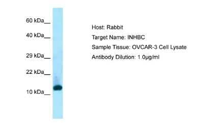 Western Blot: Activin C/Inhibin beta C Antibody [NBP1-98297]