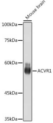 Western Blot: Activin RIA/ALK-2/Activin Receptor Type 1 Antibody (1J7G4) [NBP3-15732]