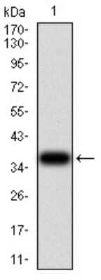 Western Blot: Activin RIA/ALK-2/Activin Receptor Type 1 Antibody (2C1E8)BSA Free [NBP2-61798]