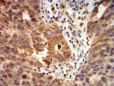 Immunohistochemistry-Paraffin: Activin RIA/ALK-2/Activin Receptor Type 1 Antibody (2E2C11) - BSA Free [NBP2-61799]