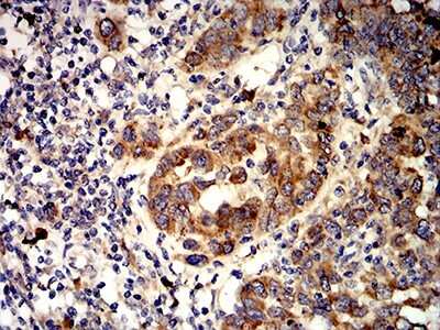 Immunohistochemistry-Paraffin: Activin RIA/ALK-2/Activin Receptor Type 1 Antibody (2E2C11) - BSA Free [NBP2-61799]