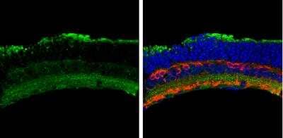 Immunohistochemistry-Frozen: Activin RIA/ALK-2/Activin Receptor Type 1 Antibody [NBP1-33500]