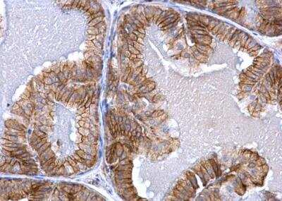 Immunohistochemistry-Paraffin: Activin RIA/ALK-2/Activin Receptor Type 1 Antibody [NBP1-33096]