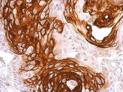 Immunohistochemistry-Paraffin: Activin RIA/ALK-2/Activin Receptor Type 1 Antibody [NBP1-33096]