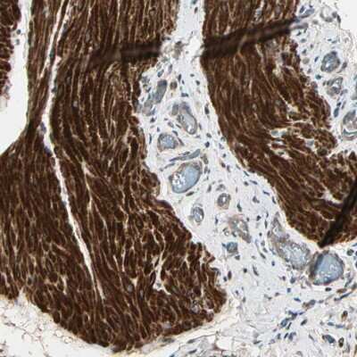 Immunohistochemistry-Paraffin: Activin RIA/ALK-2/Activin Receptor Type 1 Antibody [NBP1-90255]