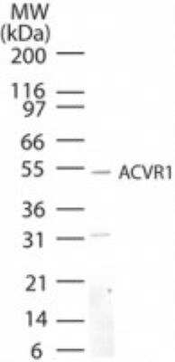 Western Blot: Activin RIA/ALK-2/Activin Receptor Type 1 Antibody [NB100-56432]