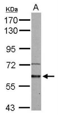 Western Blot: Activin RIA/ALK-2/Activin Receptor Type 1 Antibody [NBP1-33500]