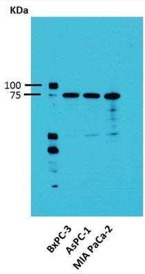 Western Blot: Activin RIA/ALK-2/Activin Receptor Type 1 Antibody [NBP1-33500]