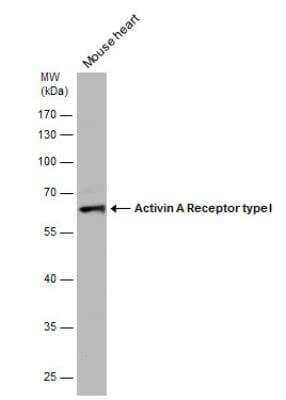 Western Blot: Activin RIA/ALK-2/Activin Receptor Type 1 Antibody [NBP1-33500]