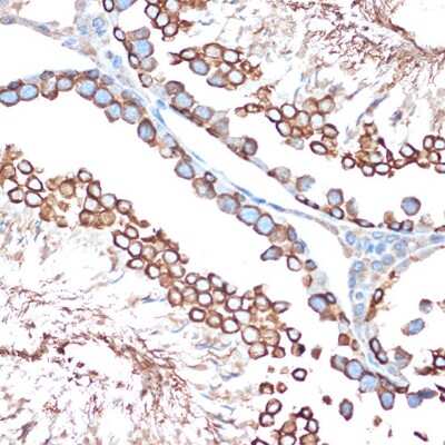Immunohistochemistry-Paraffin: Activin RIB/ALK-4 Antibody (3U6I8) [NBP3-16106]