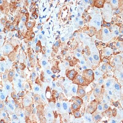 Immunohistochemistry-Paraffin: Activin RIB/ALK-4 Antibody (3U6I8) [NBP3-16106]