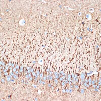 Immunohistochemistry-Paraffin: Activin RIB/ALK-4 Antibody (3U6I8) [NBP3-16106]