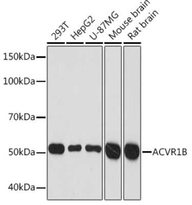 Western Blot: Activin RIB/ALK-4 Antibody (3U6I8) [NBP3-16106]