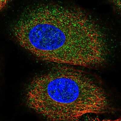 Immunocytochemistry/ Immunofluorescence: Activin RIB/ALK-4 Antibody [NBP2-39003]