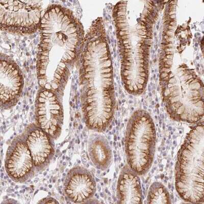 Immunohistochemistry-Paraffin: Activin RIB/ALK-4 Antibody [NBP2-39003]