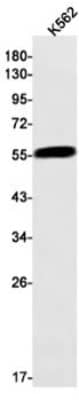 Western Blot: Activin RIB/ALK-4 Antibody (S07-7H9) [NBP3-19557]