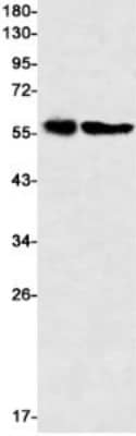 Western Blot: Activin RIB/ALK-4 Antibody (S08-8D6) [NBP3-19558]