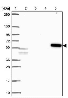 Western Blot: Activin RIB/ALK-4 Antibody [NBP2-39003]