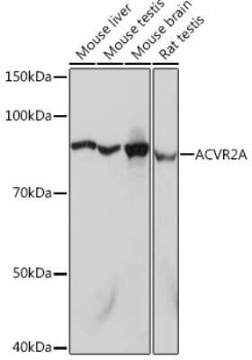 Western Blot: Activin RIIA Antibody (1K1J10) [NBP3-16598]