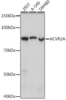 Western Blot: Activin RIIA Antibody (1K1J10) [NBP3-16598]