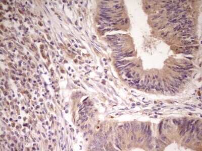 Immunohistochemistry: Activin RIIA Antibody (OTI5D1) [NBP2-46491]