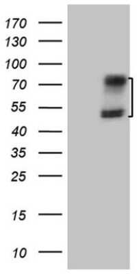 Western Blot: Activin RIIA Antibody (OTI5D1) [NBP2-46491]