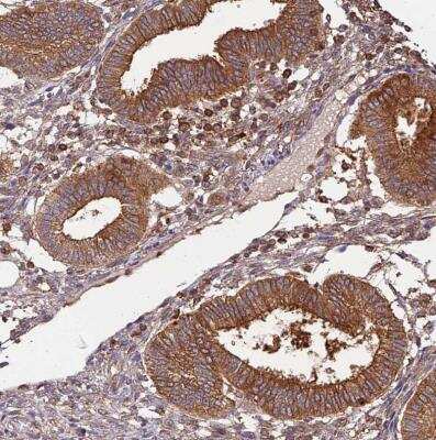 Immunohistochemistry-Paraffin: Activin RIIA Antibody [NBP1-91647]