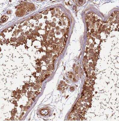 Immunohistochemistry-Paraffin: Activin RIIA Antibody [NBP1-91647]