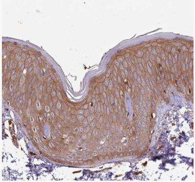 Immunohistochemistry-Paraffin: Activin RIIA Antibody [NBP1-91647]