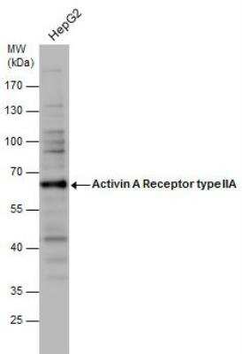 Western Blot: Activin RIIA Antibody [NBP1-33601]