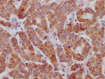 Immunohistochemistry: Activin RIIB Antibody (7B10) [NBP3-15231]