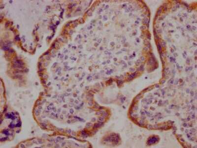 Immunohistochemistry: Activin RIIB Antibody (7B10) [NBP3-15231]