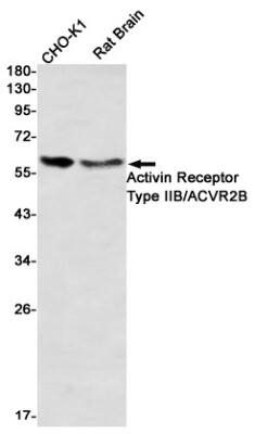 Western Blot: Activin RIIB Antibody (S01-2I1) [NBP3-19830]