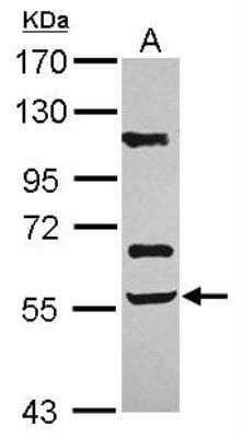 Western Blot: Activin RIIB Antibody [NBP2-15268]