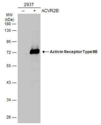 Western Blot: Activin RIIB Antibody [NBP2-15268]